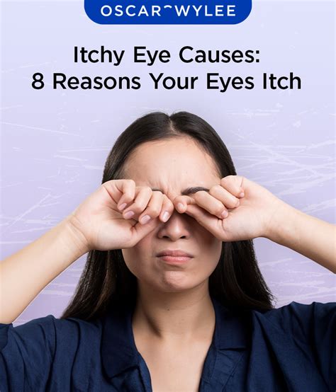 5 Causes Of Itchy Eyes In Icd 10