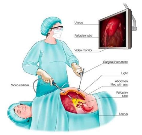 5 Essential Cpt Codes For Exploratory Laparoscopy Procedures