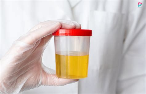 5 Ways To Keep Urine Warm For Testing