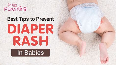 5 Ways To Prevent Diaper Dermatitis Icd 10