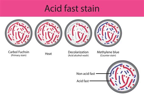 7 Steps To Acid Fast Stain Like A Pro