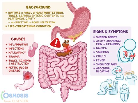 Bowel Perforation Icd 10: Causes, Symptoms, And Treatment