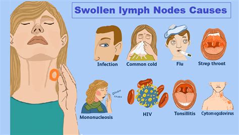 Causes Of A Swollen Preauricular Lymph Node Explained