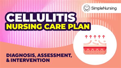 Cellulitis Nursing Care Plan And Management Guidelines