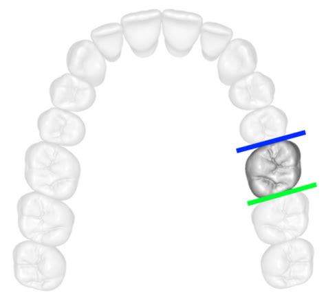 Exploring The Surfaces Of The Teeth