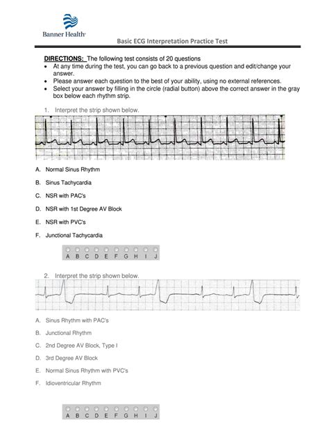 Free Ekg Exam Practice Test Questions And Study Guide