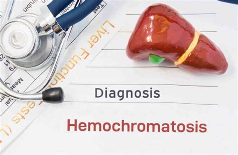 Hereditary Hemochromatosis Icd 10: Causes, Symptoms & Treatment