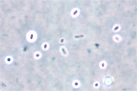 Klebsiella Pneumoniae Capsule Stain Techniques And Applications