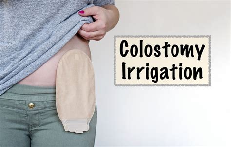 Lpns Role In Colostomy Irrigation: 5 Key Facts