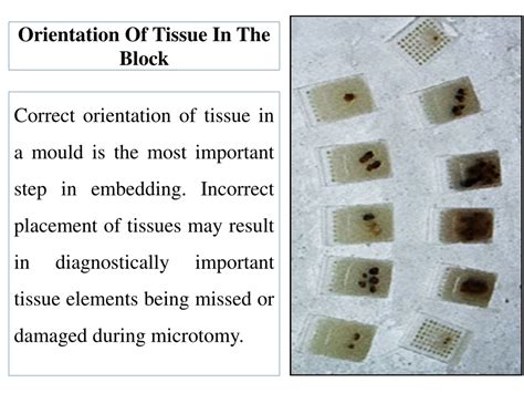 Mastering On-End Histology For Accurate Embedding Techniques