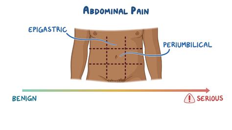 Periumbilical Pain Icd 10: Causes, Symptoms, And Diagnosis